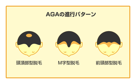 発現部位