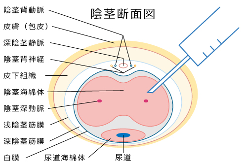 陰茎断面図